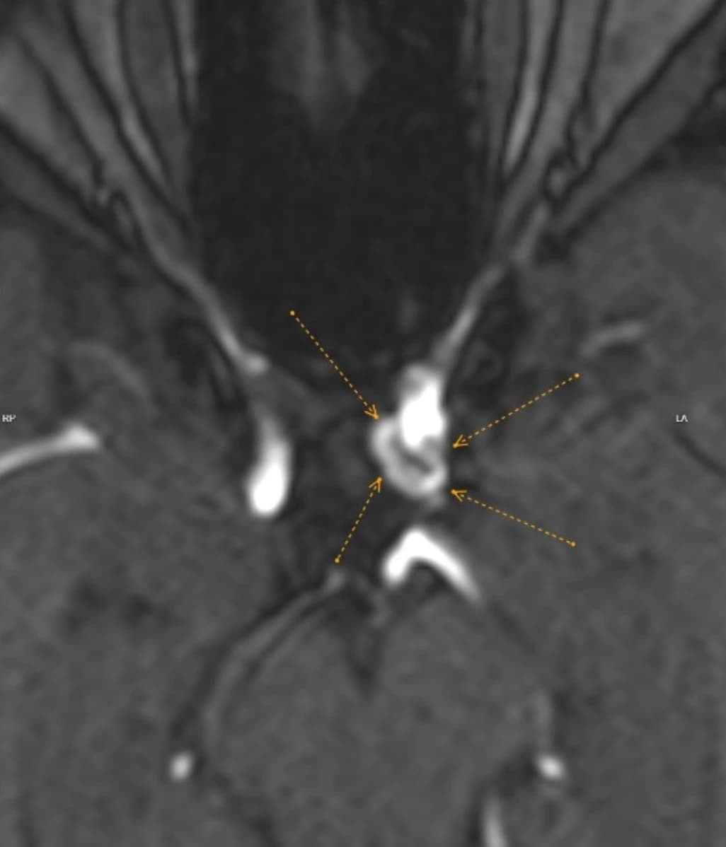 Lynn's imaging report — prior phase of care