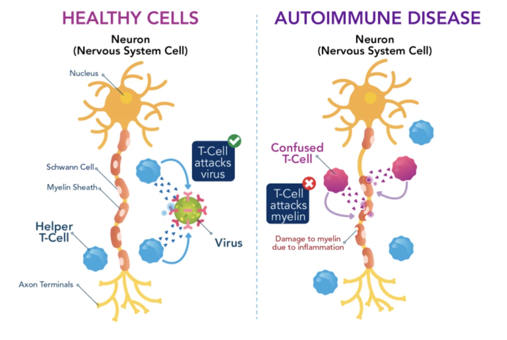 Illustration of the immune system mistakenly attacking healthy tissue in autoimmune disease